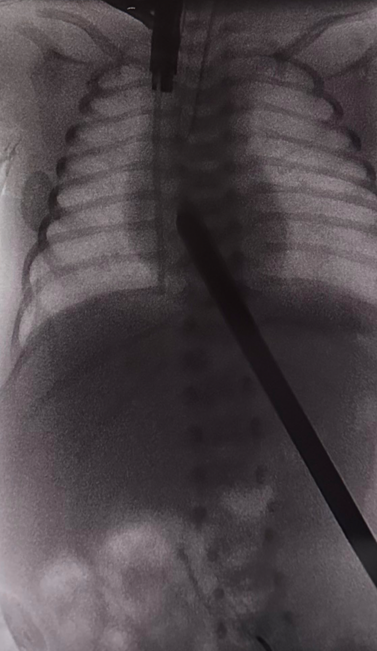 Imani NICU 3